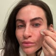 I Tried the Viral Alternative to Microneedling, and I'll Never Go Back
